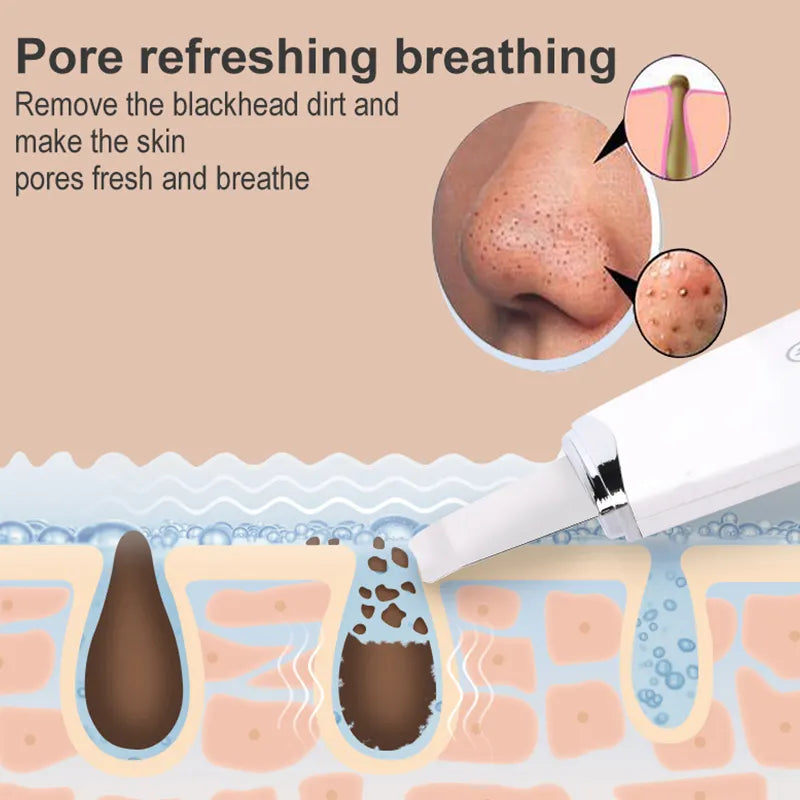 Skin Scrubbing Ultasonic