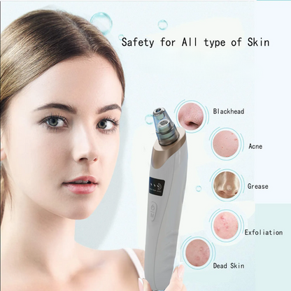 Blackhead Remover Pore Vacuum With 5 Suction Heads
