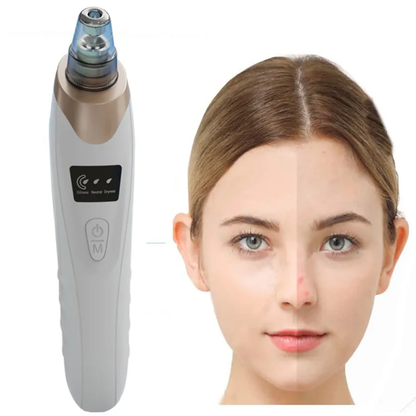 Blackhead Remover Pore Vacuum With 5 Suction Heads