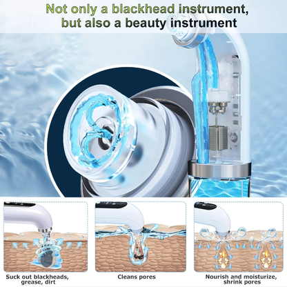 Facial Pore Cleaner Vacuum And Blackhead Remover